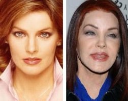 Priscilla-Presley-Bad-Plastic-Surgery